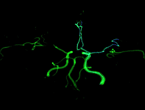 Cerebral vascular tree