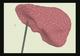liver1.mpg [3Mo]